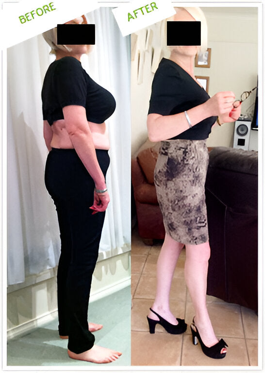CATHERINE BEFORE AFTER.jpg__PID:41dc21e2-2c74-4fe7-a88d-3bdd37f7b893
